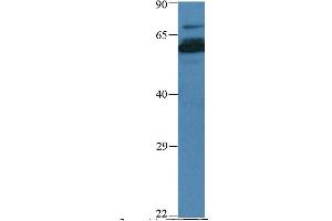 Host:  Rabbit  Target Name:  PHF15  Sample Type:  Human muscle  Antibody Dilution:  1. (PHF15 antibody  (N-Term))
