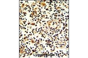 Formalin-fixed and paraffin-embedded human lymph with KLRD1 Antibody (N-term), which was peroxidase-conjugated to the secondary antibody, followed by DAB staining. (CD94 antibody  (N-Term))