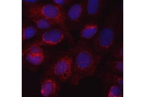 IF analysis of eNOS/NOS3 using anti-eNOS/NOS3 antibody (ABIN7601375). (ENOS antibody  (AA 34-1153))