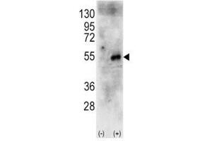 Western Blotting (WB) image for anti-Ribosomal Protein S6 Kinase, 70kDa, Polypeptide 2 (RPS6KB2) (AA 243-272) antibody (ABIN3028985)