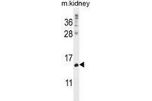 Western blot analysis in mouse kidney tissue lysates (35ug/lane) using MORN5 Antibody (C-term).