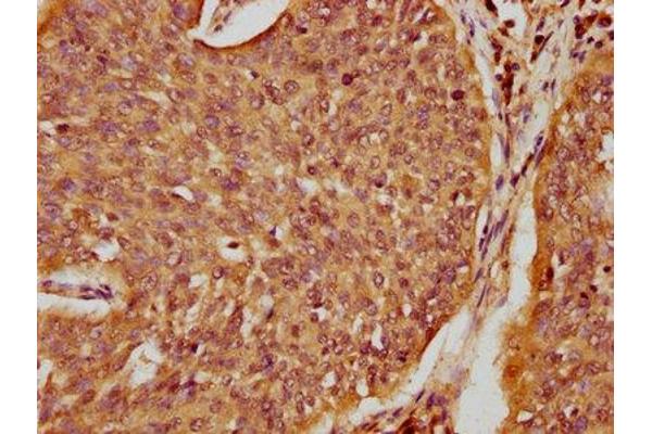 SPINK5 antibody  (AA 722-847)