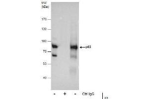 IP Image Immunoprecipitation of p63 protein from A431 whole cell extracts using 5 μg of p63 antibody [N2C1], Internal, Western blot analysis was performed using p63 antibody [N2C1], Internal, EasyBlot anti-Rabbit IgG  was used as a secondary reagent.