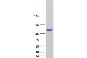 Western Blotting (WB) image for 4-Aminobutyrate Aminotransferase (ABAT) (Transcript Variant 3) protein (Myc-DYKDDDDK Tag) (ABIN2714261)