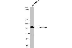 WB Image Rat tissue extract (50 μg) was separated by 7. (PLG antibody)