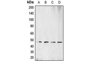 Western blot analysis of BCKDK expression in Raji (A), HeLa (B), Jurkat (C), SHSY5Y (D) whole cell lysates.