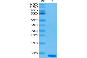 Human EGF on Tris-Bis PAGE under reduced condition. (EGF Protein)