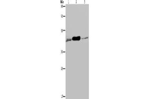 Western Blotting (WB) image for anti-Isocitrate Dehydrogenase 2 (NADP+), Mitochondrial (IDH2) antibody (ABIN2430283)
