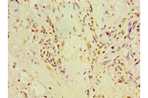 Immunohistochemistry (IHC) image for anti-Prolyl 4-Hydroxylase, alpha Polypeptide II (P4HA2) (AA 236-535) antibody (ABIN7164785)