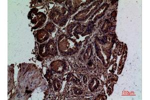 Immunohistochemistry (IHC) analysis of paraffin-embedded Human Prostate Cancer, antibody was diluted at 1:100. (CD300LG antibody  (Internal Region))