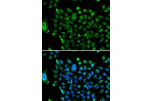 Immunofluorescence analysis of U20S cell using NCOR1 antibody. (NCOR1 antibody)