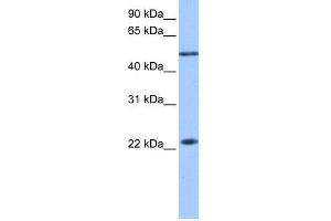 WB Suggested Anti-PIAS2 Antibody Titration: 0. (PIAS2 antibody  (N-Term))