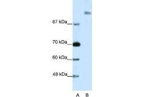 WB Suggested Anti-SUPT6H Antibody Titration:  2. (Spt6 antibody  (N-Term))