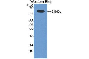 Western Blotting (WB) image for anti-Sialic Acid Acetylesterase (SIAE) (AA 22-244) antibody (ABIN1860549)