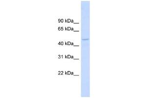 WB Suggested Anti-DBNL Antibody Titration: 0. (DBNL antibody  (Middle Region))