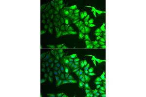 Immunofluorescence analysis of HeLa cells using  antibody (ABIN6129964, ABIN6136691, ABIN6136693 and ABIN6222112). (AIPL1 antibody  (AA 1-384))