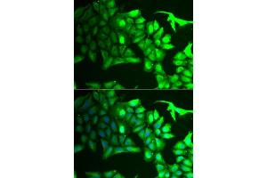 Immunofluorescence analysis of HeLa cells using  antibody (ABIN6129964, ABIN6136691, ABIN6136693 and ABIN6222112). (AIPL1 antibody  (AA 1-384))