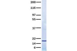Validation with Western Blot (IL17B Protein)