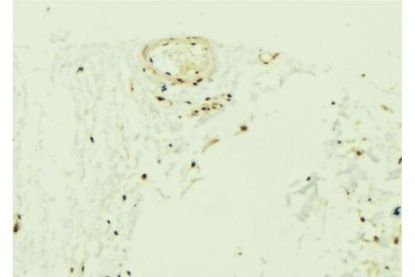 ZNF592 antibody  (Internal Region)