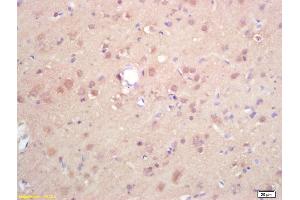 Formalin-fixed and paraffin embedded rat brain labeled with Rabbit Anti DGAT1/Diglyceride acyltransferase Polyclonal Antibody, Unconjugated (ABIN679568) at 1:200 followed by conjugation to the secondary antibody and DAB staining