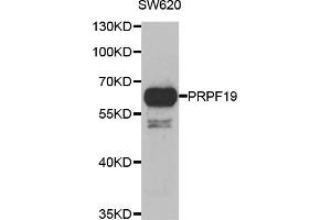 Western blot analysis of extracts of SW620 cells, using PRPF19 antibody. (PRP19 antibody)
