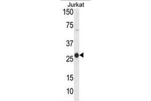 Western blot analysis of CD160 Antibody (Center) in Jurkat cell line lysates (35µg/lane). (CD160 antibody  (Middle Region))