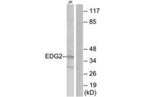 Western blot analysis of extracts from Jurkat cells, using EDG2 Antibody.