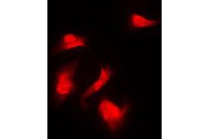 Immunofluorescent analysis of S6K1 (pS418) staining in HeLa cells. (RPS6KB1 antibody  (C-Term, pSer418))