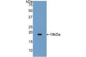 Western blot analysis of recombinant Human a2PI. (alpha 2 Antiplasmin antibody  (AA 340-491))