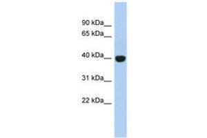 Image no. 1 for anti-KIAA1191 (KIAA1191) (AA 179-228) antibody (ABIN6744040) (KIAA1191 antibody  (AA 179-228))