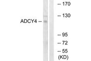 Western blot analysis of extracts from Jurkat cells, using ADCY4 Antibody.