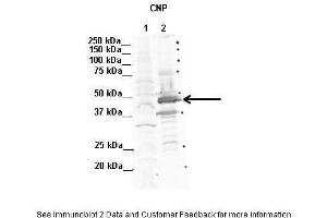 Lanes:   1. (Cnpase antibody  (N-Term))