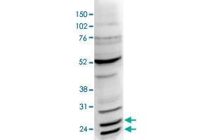 Nuclear extracts of HeLa cells (40 ug) were analysed by Western blot using BCL7C polyclonal antibody  diluted 1 : 1,000 in TBS-Tween containing 5% skimmed milk. (BCL7C antibody)