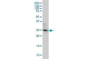 PGRMC2 monoclonal antibody (M04), clone 3C11 Western Blot analysis of PGRMC2 expression in HeLa (PGRMC2 antibody  (AA 124-223))