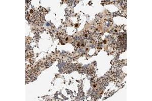 Immunohistochemical staining of human bone marrow with ZBTB34 polyclonal antibody  shows strong nuclear positivity in megakaryocytes. (ZBTB34 antibody)