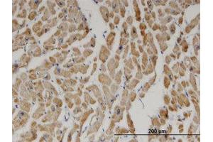 Image no. 1 for anti-2,4-Dienoyl CoA Reductase 1, Mitochondrial (DECR1) (AA 236-336) antibody (ABIN599370) (DECR1 antibody  (AA 236-336))