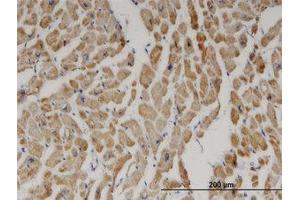 Image no. 1 for anti-2,4-Dienoyl CoA Reductase 1, Mitochondrial (DECR1) (AA 236-336) antibody (ABIN599370)