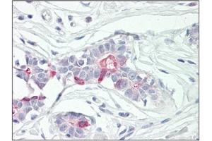Human Breast: Formalin-Fixed, Paraffin-Embedded (FFPE) (TNFAIP8 antibody)