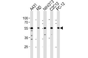 Western blot analysis of lysates from A431, RD, mouse NIH/3T3, mouse C2C12, rat PC-12 cell line (from left to right), using SRC Antibody (N-term) (ABIN1881832 and ABIN2838676). (Src antibody  (N-Term))