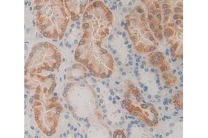 Used in DAB staining on fromalin fixed paraffin- embedded Kidney tissue (PNPO antibody  (AA 1-261))