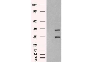 Western Blotting (WB) image for Sirtuin 3 (SIRT3) peptide (ABIN369690)