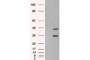 Western Blotting (WB) image for Sirtuin 3 (SIRT3) peptide (ABIN369690) (Sirtuin 3 (SIRT3) Peptide)
