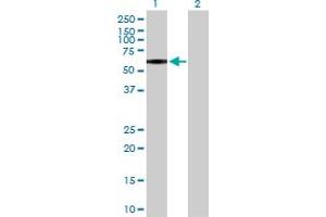 Western Blot analysis of P2RX4 expression in transfected 293T cell line by P2RX4 MaxPab polyclonal antibody. (P2RX4 antibody  (AA 1-388))