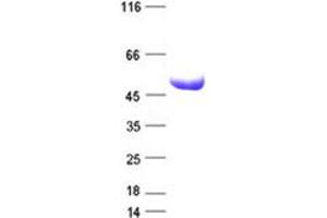 Validation with Western Blot (ABCB1 Protein (His tag))