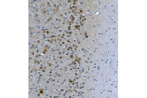 IHC analysis of LSM7 using anti-LSM7 antibody (ABIN7598937). (LSM7 antibody  (AA 1-103))