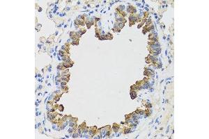 Immunohistochemistry of paraffin-embedded mouse lung using B9D1 antibody.