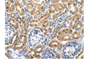 Enolase 3 antibody was used for immunohistochemistry at a concentration of 4-8 ug/ml to stain Epithelial cells of renal tubule (arrows) in Human Kidney.
