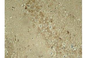 Immunohistochemical analysis of paraffin-embedded rat hippocampal region tissue from a model with Alzheimer (MAPT antibody  (pSer262))