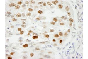 Immunohistochemistry (IHC) image for anti-Importin Subunit alpha-1 (KPNA2) (C-Term) antibody (ABIN7448767) (Importin Subunit alpha-1 (KPNA2) (C-Term) antibody)