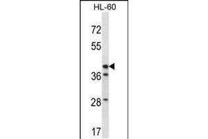 Western Blotting (WB) image for anti-Hydroxy-delta-5-Steroid Dehydrogenase, 3 beta- and Steroid delta-Isomerase 1 (HSD3B1) (AA 26-55), (N-Term) antibody (ABIN5535214)